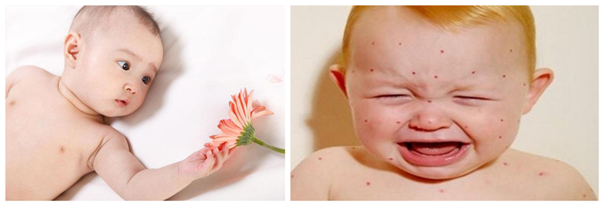 兒童濕疹反反復(fù)復(fù)，您有在家安裝家用除濕產(chǎn)品嗎？_重復(fù)